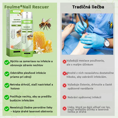 🔥Najobľúbenejšie丨50 % zľava na obmedzený čas | Foulme® NailRescue sprej s včelím jedom🐝