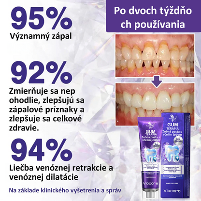 🌟Obľúbený produkt Maďarov丨Rolimey® VioCore Zubná pasta s včelím jedom